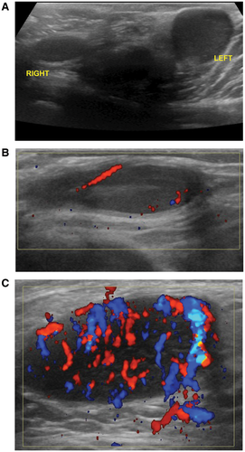 Details are in the caption following the image Details are in the caption following the image